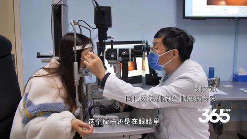 吃瓜视频在线眼科医生,守护视力健康新篇章